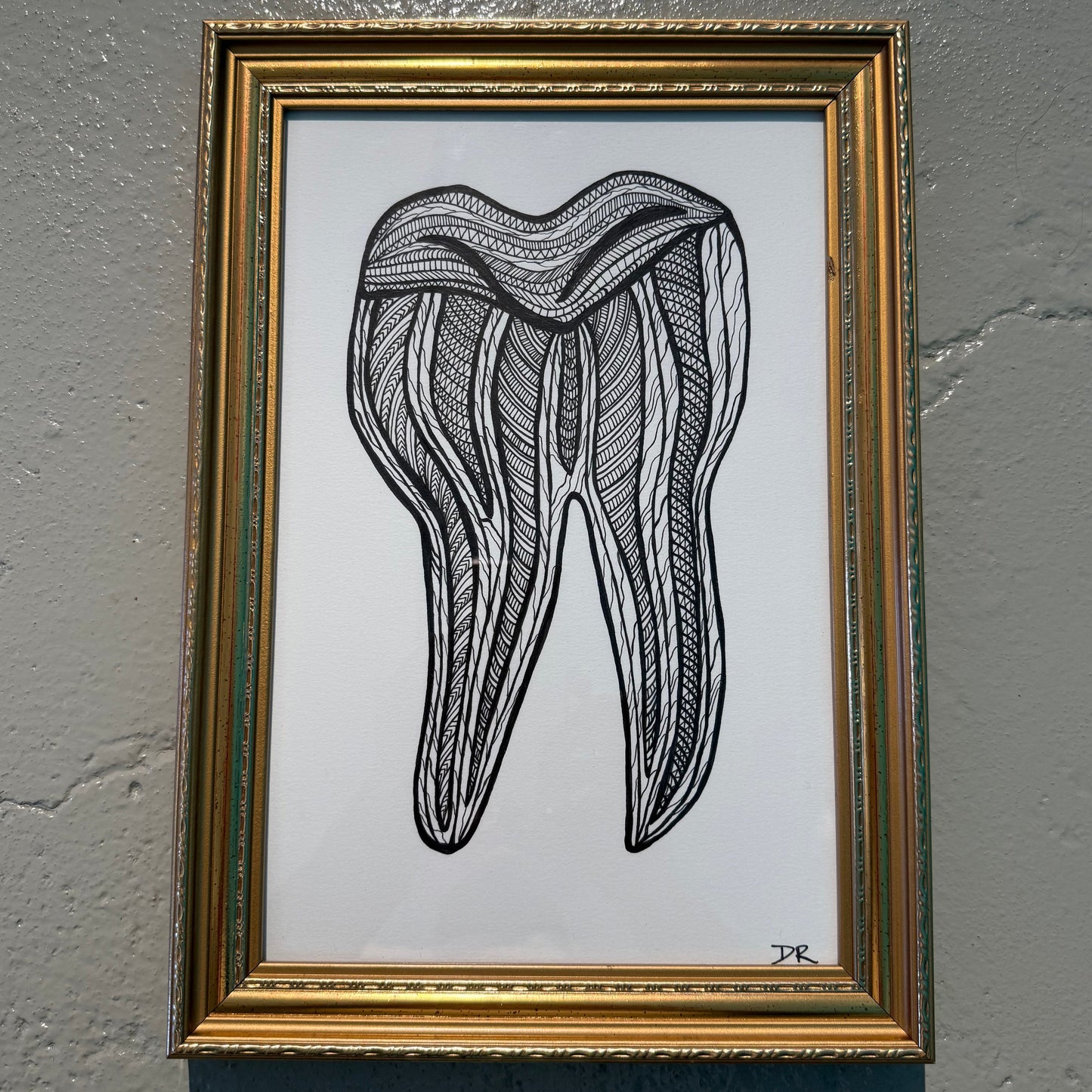 TOOTH